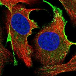 CTDSPL Antibody, Novus Biologicals 0.1mL; Unlabeled:Antibodies, Polyclonal